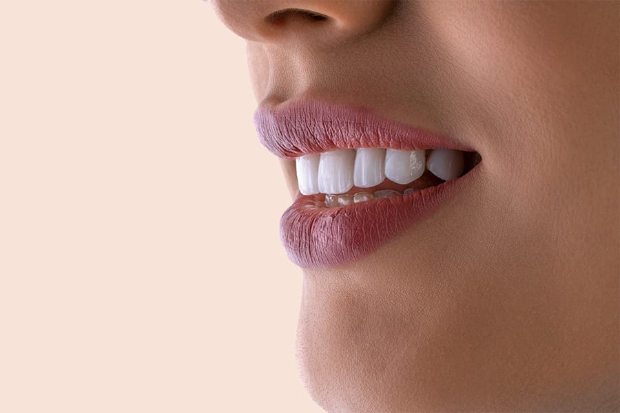 blanqueamiento-dental-en-santiago