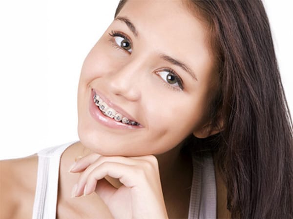 brackets-en-santiago-rd