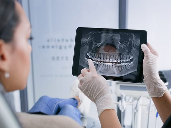 radiografia-dental